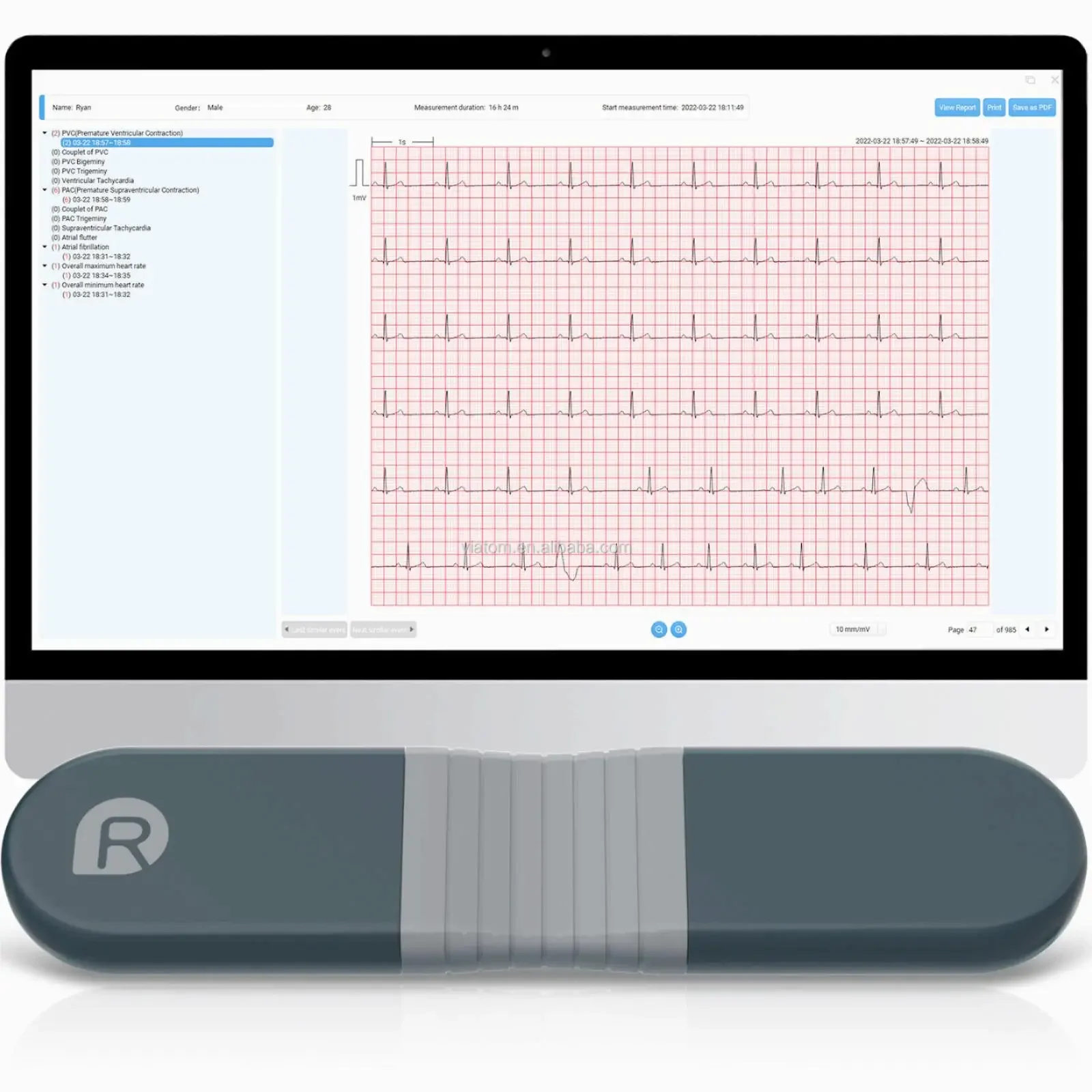 Wireless Bluetooth Dynamic Rec - Ecg Patch Monitor 评论和价格